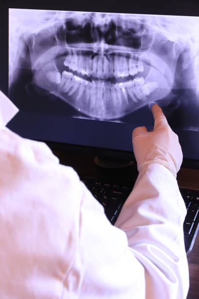 Best Emergency Treatment for Toothache in Glasgow, OR